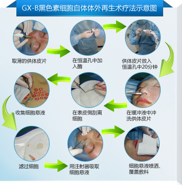 GX-B��ɫ��ϸ�����������������Ʒ�ͼ