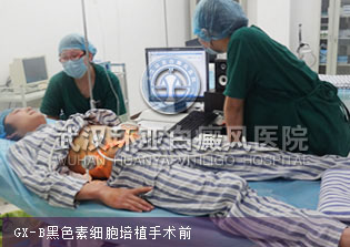 黑色素细胞培植前