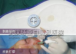 剥离细胞