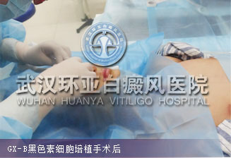 黑色素细胞培植后