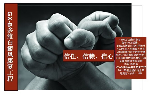 GX-B��ά���翵������֮������ϵ�ص�