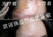 孙某某