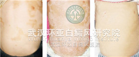 10-120G9155315X4.jpg
